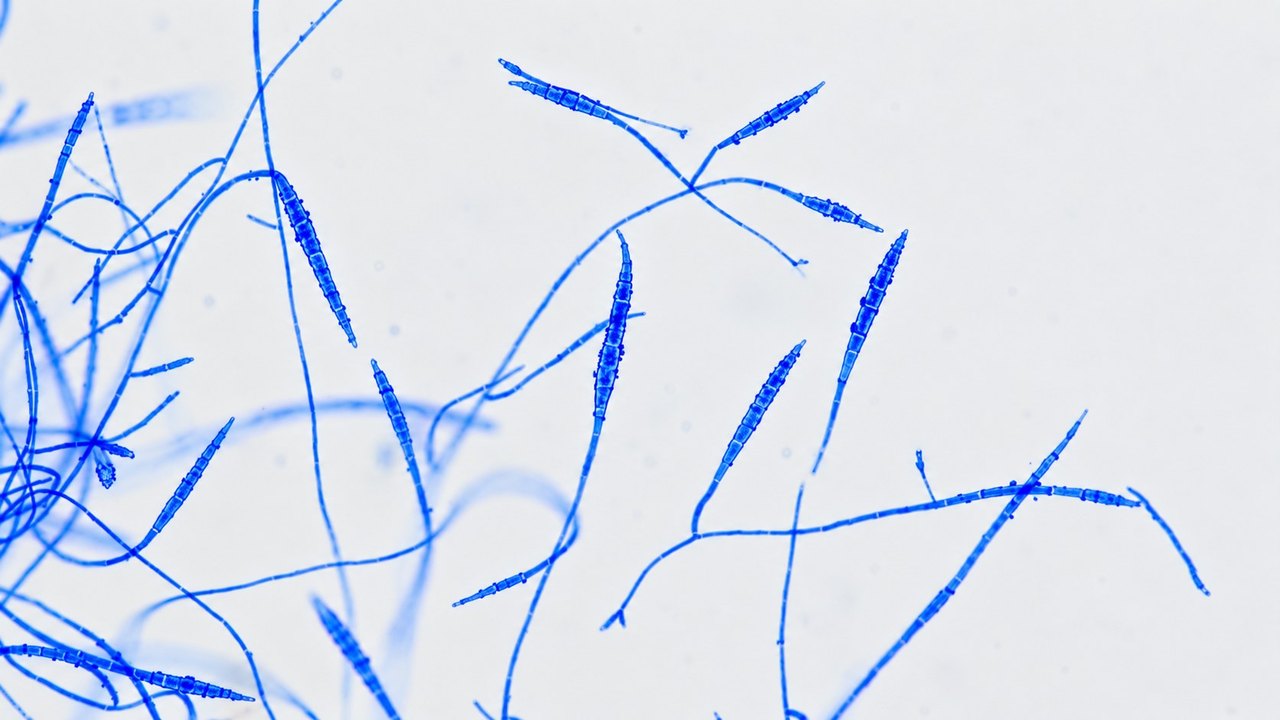 Mikroskopski prikaz makrokonidija Trichophyton dermatofita u VetPro laboratoriji.